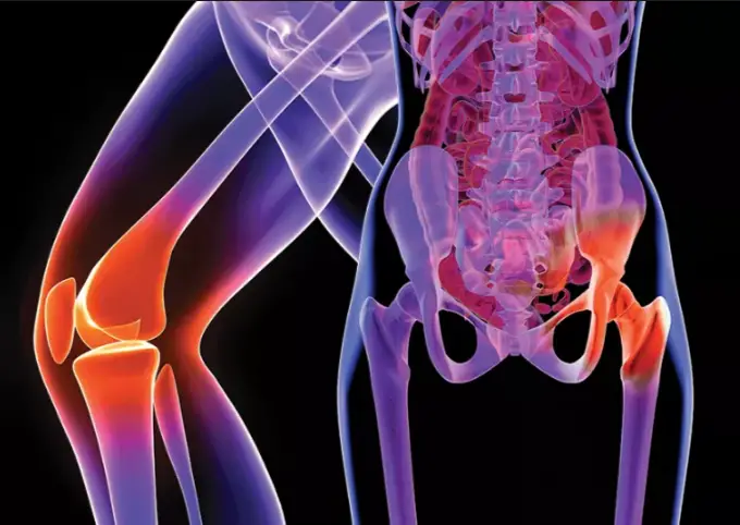 can hip pain cause knee pain
