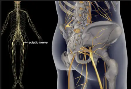 Sciatic Nerve Pain Causes and Treatments
