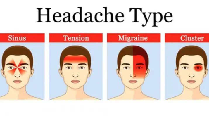 Types Of Headaches And Symptoms Chart