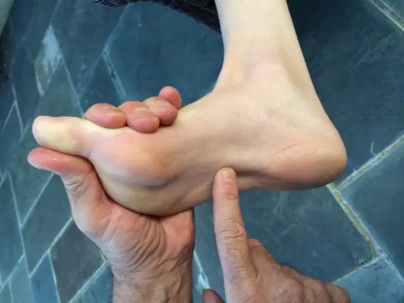 severe pain in heel of foot