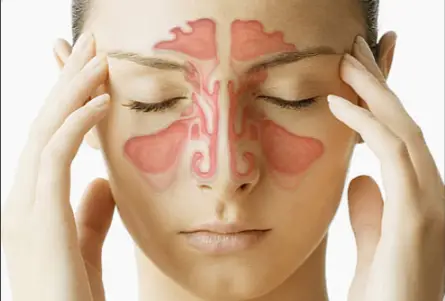 sinus headache prevention