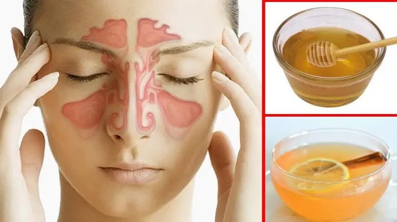 What Can I Do To Relieve My Sinus Pressure
