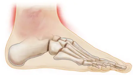Causes of Pain in Ankle