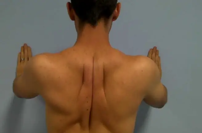 Exercises for Upper Back Pain Between Shoulder Blades