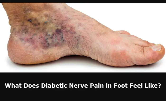 What Does Diabetic Nerve Pain in Foot Feel Like