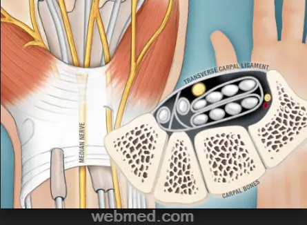 carpal tunnel syndrome causes and symptoms