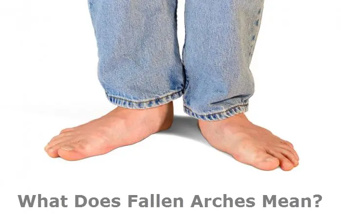 What Does Fallen Arches Mean