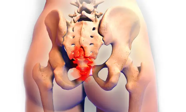 Tailbone Pain When Sitting Down and Getting Up